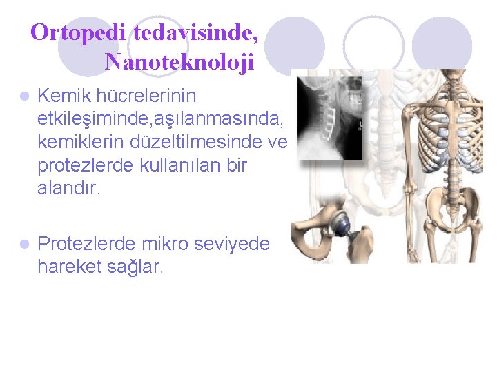 Ortopedi tedavisinde, Nanoteknoloji l Kemik hücrelerinin etkileşiminde, aşılanmasında, kemiklerin düzeltilmesinde ve protezlerde kullanılan bir