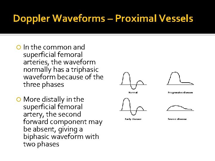 Doppler Waveforms – Proximal Vessels In the common and superficial femoral arteries, the waveform Doppler Waveforms – Proximal Vessels In the common and superficial femoral arteries, the waveform