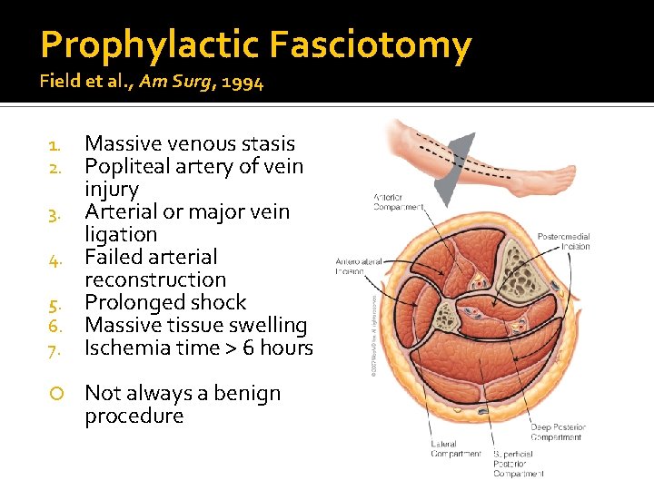 Prophylactic Fasciotomy Field et al. , Am Surg, 1994 1. 2. 3. 4. 5. Prophylactic Fasciotomy Field et al. , Am Surg, 1994 1. 2. 3. 4. 5.
