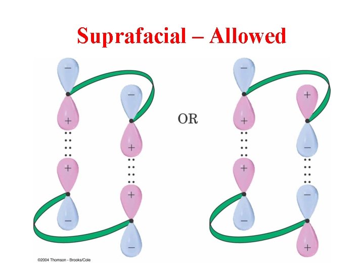 Suprafacial – Allowed 