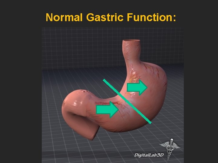 Normal Gastric Function: 