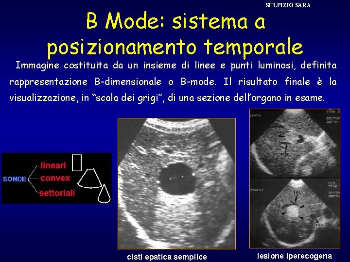 SULPIZIO SARA B Mode: sistema a posizionamento temporale Immagine costituita da un insieme di