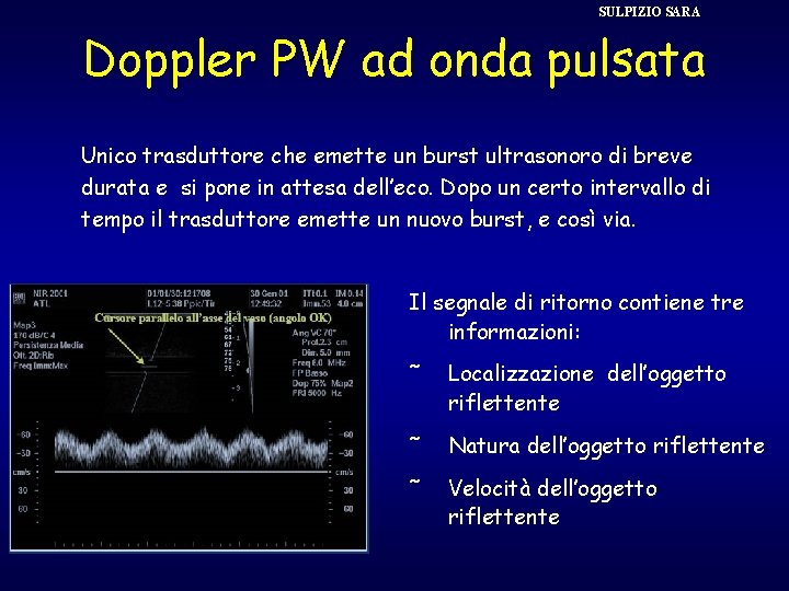 SULPIZIO SARA Doppler PW ad onda pulsata Unico trasduttore che emette un burst ultrasonoro