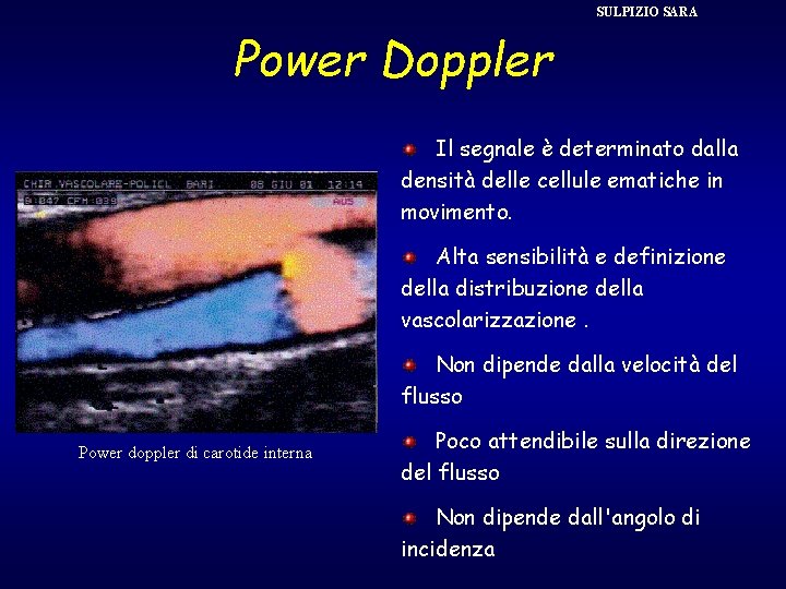 SULPIZIO SARA Power Doppler Il segnale è determinato dalla densità delle cellule ematiche in
