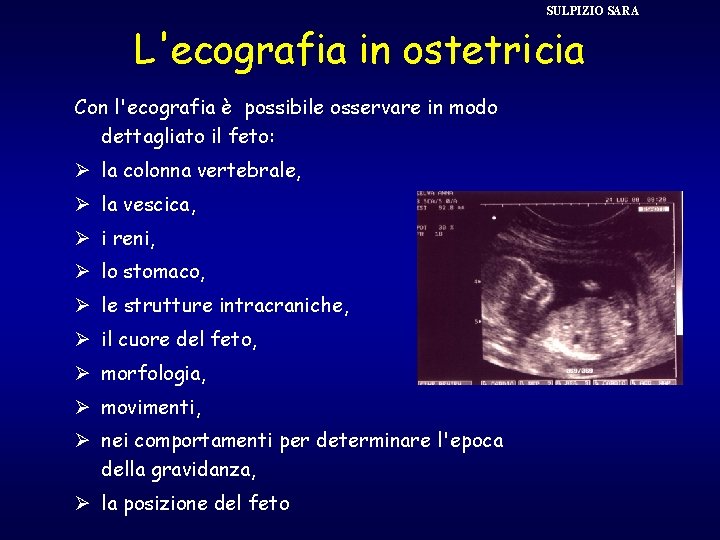 SULPIZIO SARA L'ecografia in ostetricia Con l'ecografia è possibile osservare in modo dettagliato il