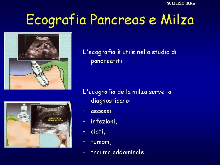 SULPIZIO SARA Ecografia Pancreas e Milza L'ecografia è utile nello studio di pancreatiti L'ecografia