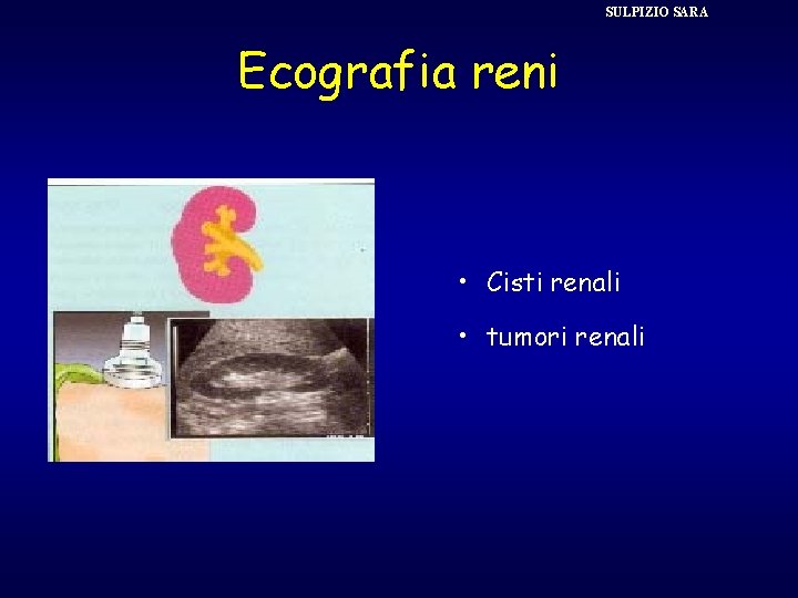 SULPIZIO SARA Ecografia reni • Cisti renali • tumori renali 