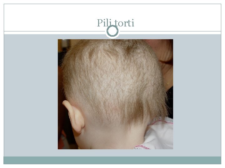 Pili torti Pili torti