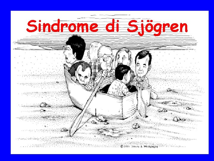 Sindrome di Sjögren 