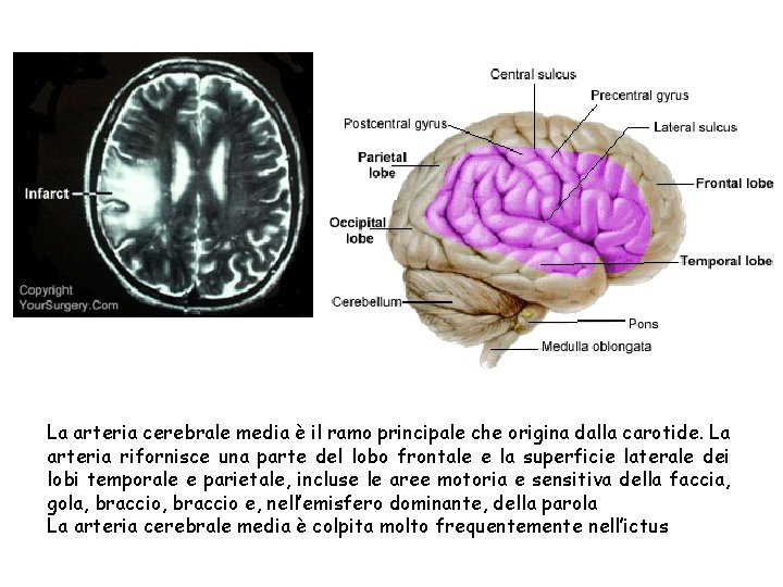 La arteria cerebrale media è il ramo principale che origina dalla carotide. La arteria