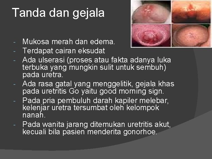 Tanda dan gejala Mukosa merah dan edema. Terdapat cairan eksudat Ada ulserasi (proses atau Tanda dan gejala Mukosa merah dan edema. Terdapat cairan eksudat Ada ulserasi (proses atau