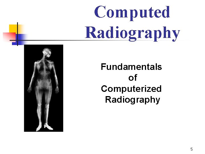 Computed Radiography Fundamentals of Computerized Radiography 5 