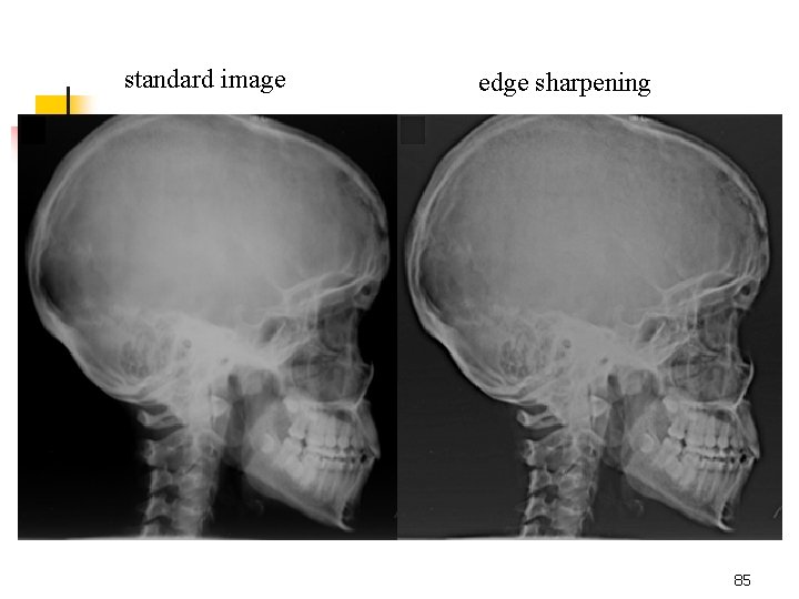 standard image edge sharpening 85 