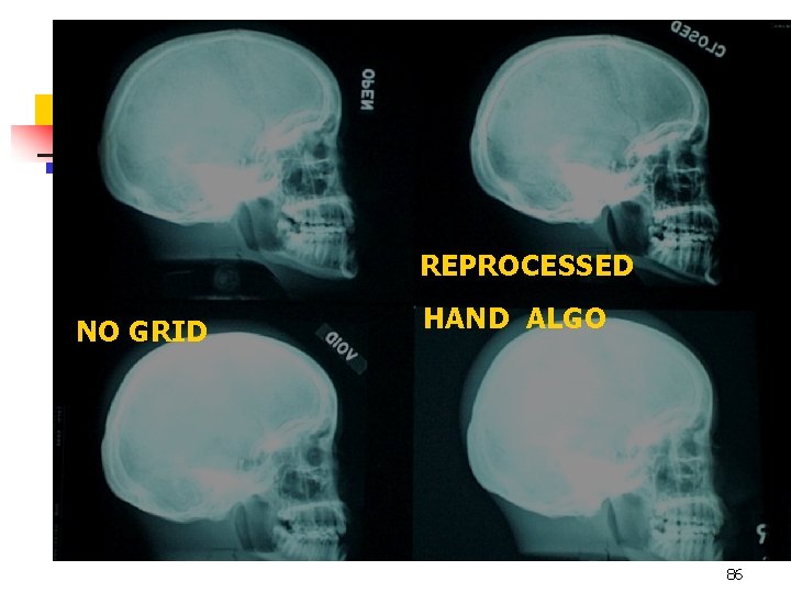 REPROCESSED NO GRID HAND ALGO 86 