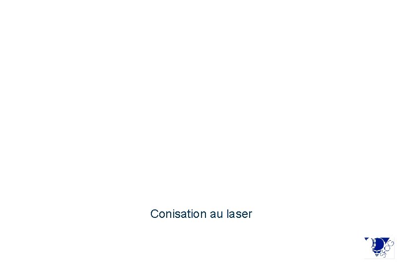Conisation au laser 