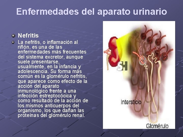 Enfermedades del aparato urinario Nefritis La nefritis, o inflamación al riñón, es una de