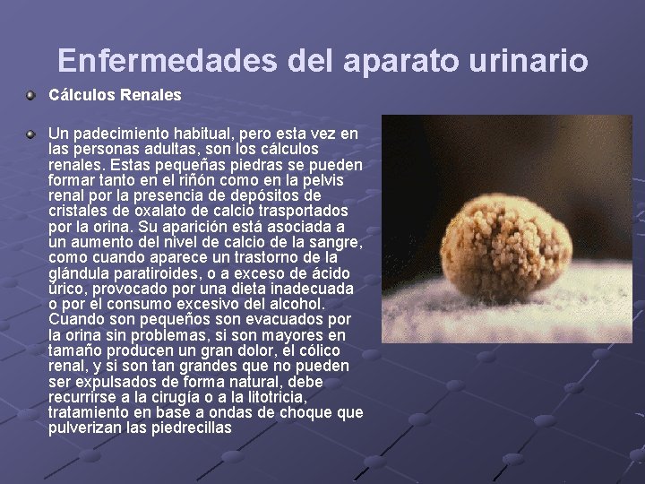 Enfermedades del aparato urinario Cálculos Renales Un padecimiento habitual, pero esta vez en las