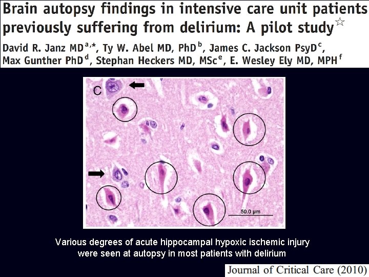 Various degrees of acute hippocampal hypoxic ischemic injury were seen at autopsy in most