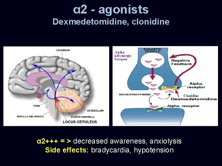 α 2 - agonists Dexmedetomidine, clonidine α 2+++ = > decreased awareness, anxiolysis Side