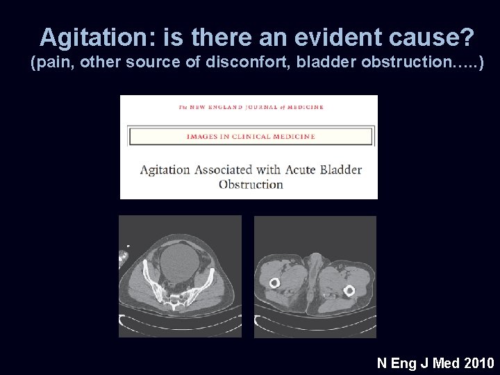 Agitation: is there an evident cause? (pain, other source of disconfort, bladder obstruction…. .