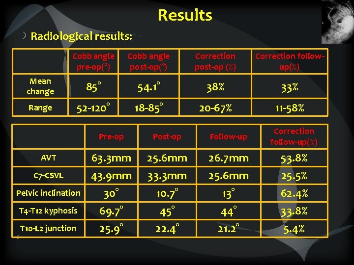 Results Radiological results: Cobb angle pre-op(°) Cobb angle post-op(°) Correction post-op (%) Correction followup(%)