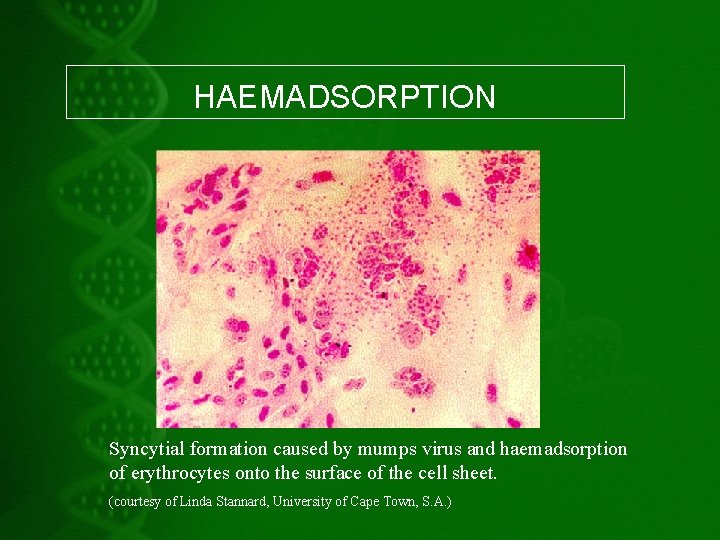 HAEMADSORPTION Syncytial formation caused by mumps virus and haemadsorption of erythrocytes onto the surface