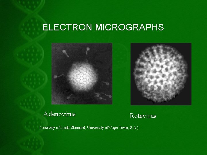 ELECTRON MICROGRAPHS Adenovirus Rotavirus (courtesy of Linda Stannard, University of Cape Town, S. A.