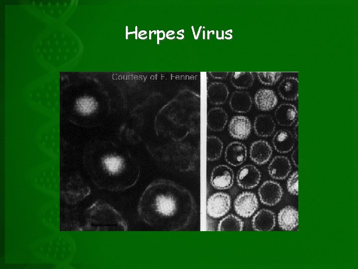 Herpes Virus 