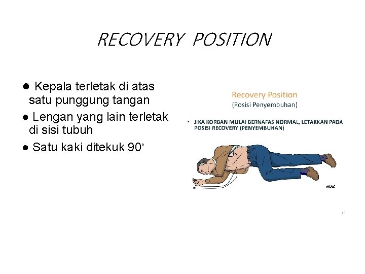 RECOVERY POSITION ● Kepala terletak di atas satu punggung tangan ● Lengan yang lain