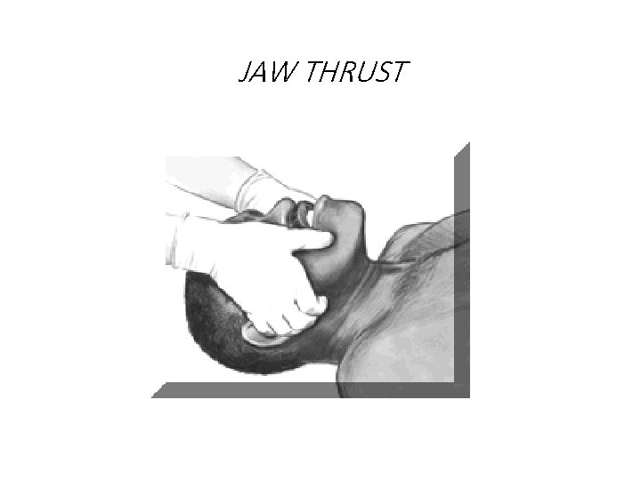 JAW THRUST 