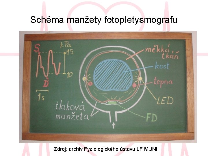 Schéma manžety fotopletysmografu Zdroj: archiv Fyziologického ústavu LF MUNI Schéma manžety fotopletysmografu Zdroj: archiv Fyziologického ústavu LF MUNI