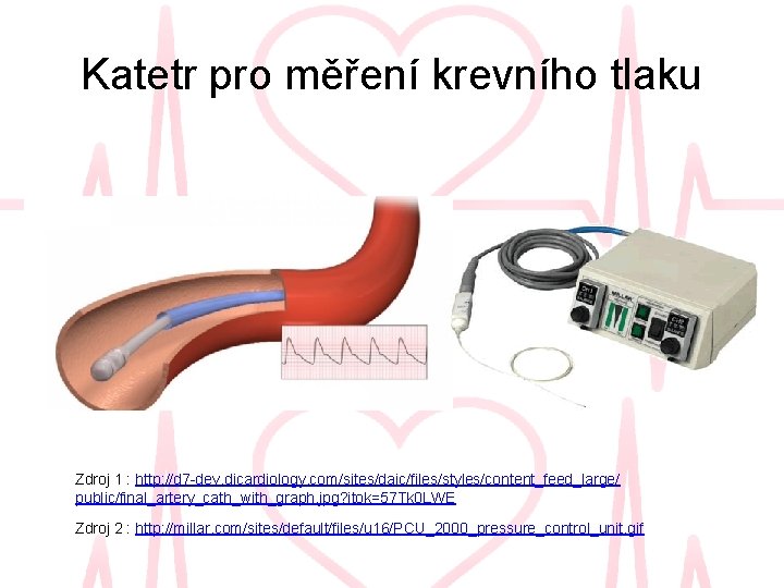 Katetr pro měření krevního tlaku Zdroj 1 : http: //d 7 -dev. dicardiology. com/sites/daic/files/styles/content_feed_large/