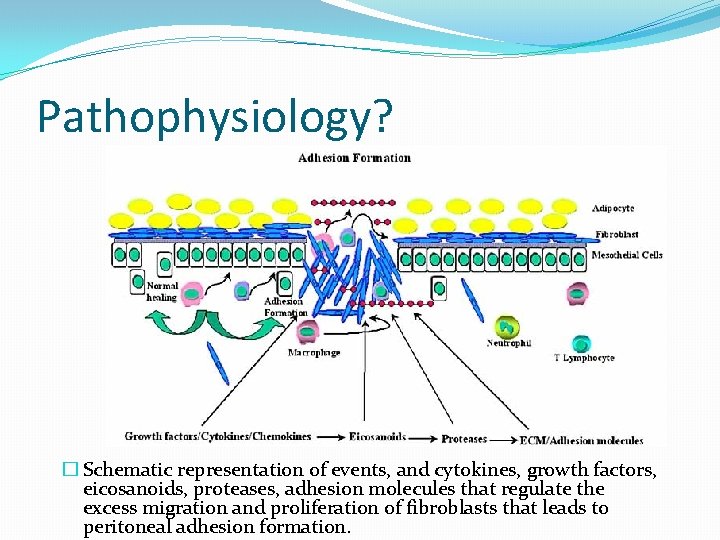 Pathophysiology? � Schematic representation of events, and cytokines, growth factors, eicosanoids, proteases, adhesion molecules