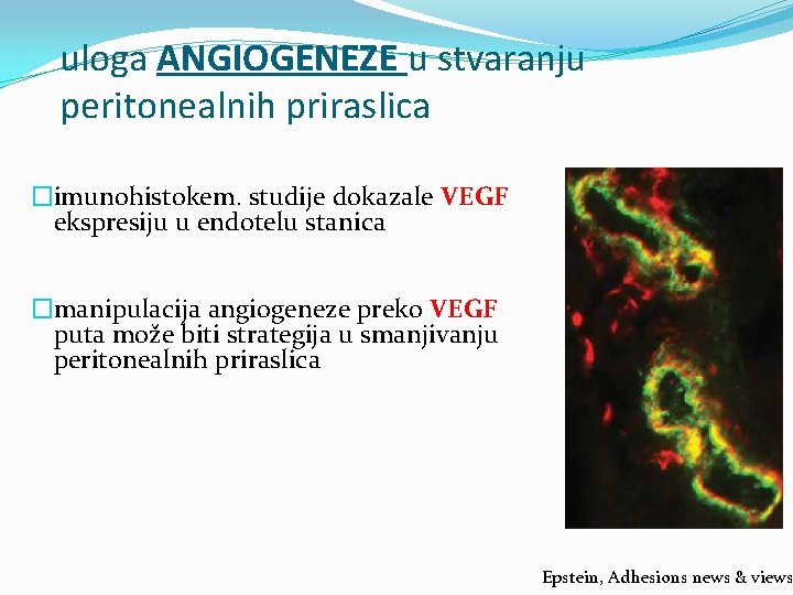 uloga ANGIOGENEZE u stvaranju peritonealnih priraslica �imunohistokem. studije dokazale VEGF ekspresiju u endotelu stanica