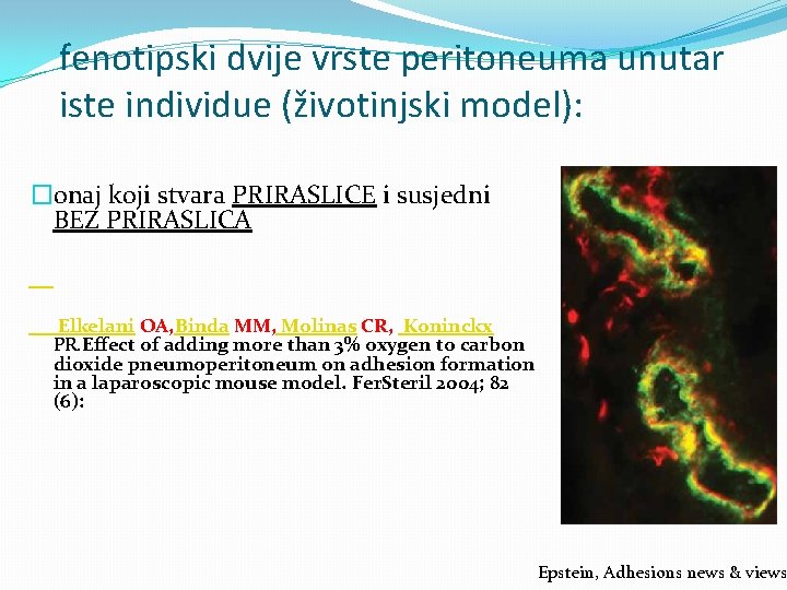 fenotipski dvije vrste peritoneuma unutar iste individue (životinjski model): �onaj koji stvara PRIRASLICE i