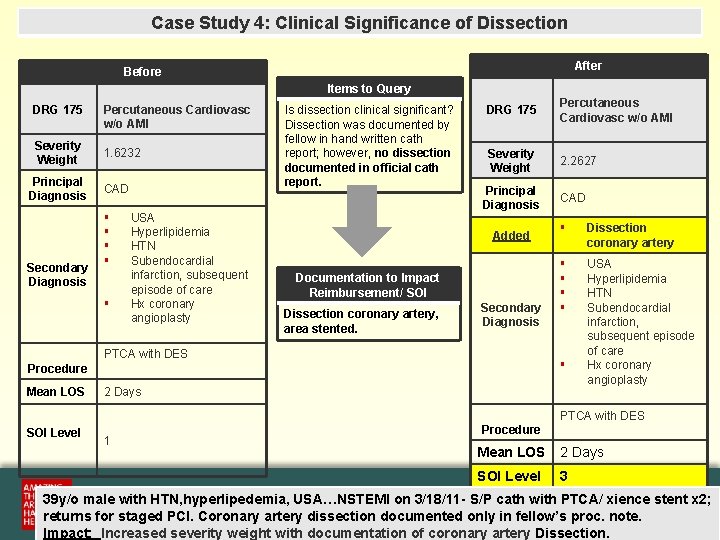 Case Study 4: Clinical Significance of Dissection After Before Items to Query DRG 175