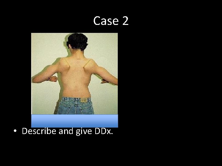 Case 2 • Describe and give DDx. 