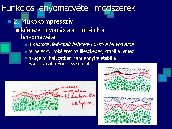 Funkciós lenyomatvételi módszerek n 2. Mukokompresszív n kifejezett nyomás alatt történik a lenyomatvétel n