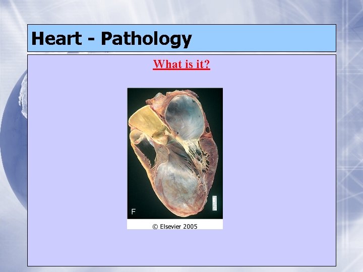 Heart - Pathology What is it? 