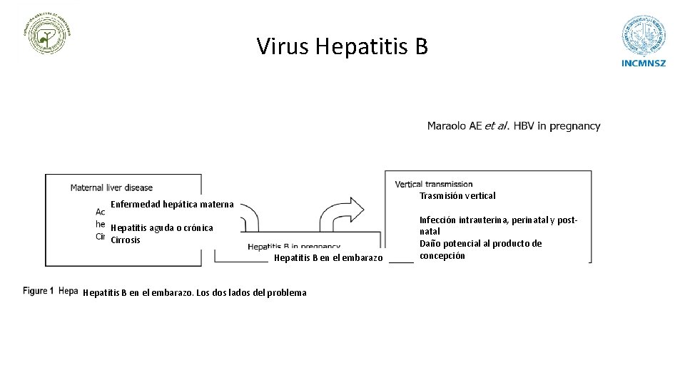 Virus Hepatitis B Trasmisión vertical Enfermedad hepática materna Hepatitis aguda o crónica Cirrosis Hepatitis