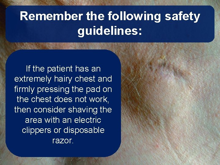 Remember the following safety guidelines: • Clear the patient before If the patient has