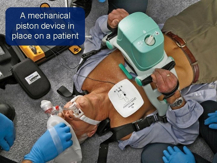 A mechanical piston device in place on a patient 