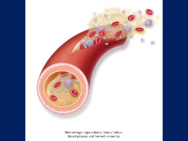 Fig. 15 -05 a only (trim out nonhemorrhagic hypovolemic shock) Don’t have art yet