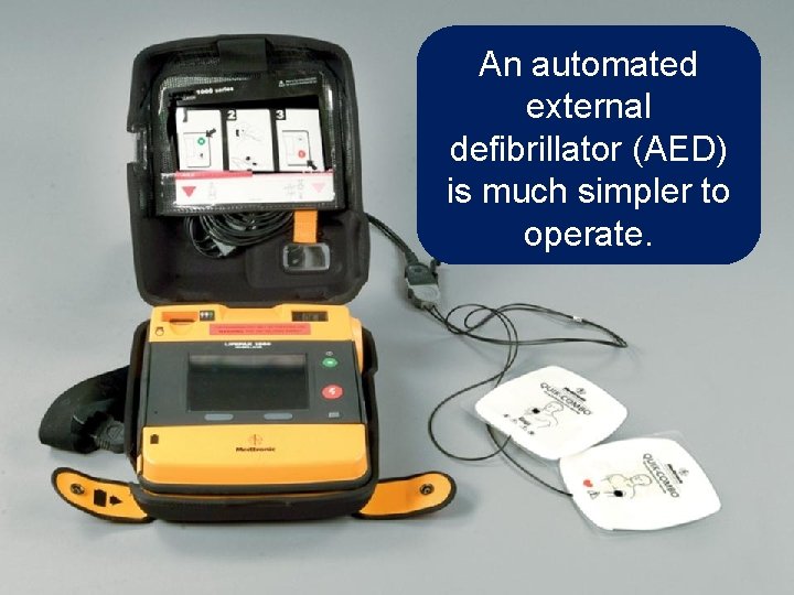 An Manual automated defibrillators external require extensive defibrillator (AED) training prior to is much
