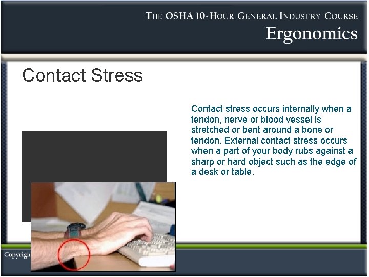 Contact Stress Contact stress occurs internally when a tendon, nerve or blood vessel is Contact Stress Contact stress occurs internally when a tendon, nerve or blood vessel is
