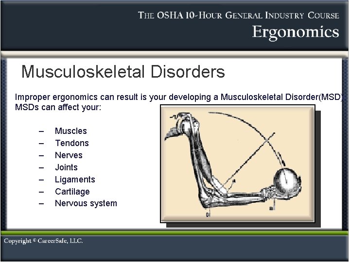 Musculoskeletal Disorders Improper ergonomics can result is your developing a Musculoskeletal Disorder(MSD). MSDs can Musculoskeletal Disorders Improper ergonomics can result is your developing a Musculoskeletal Disorder(MSD). MSDs can