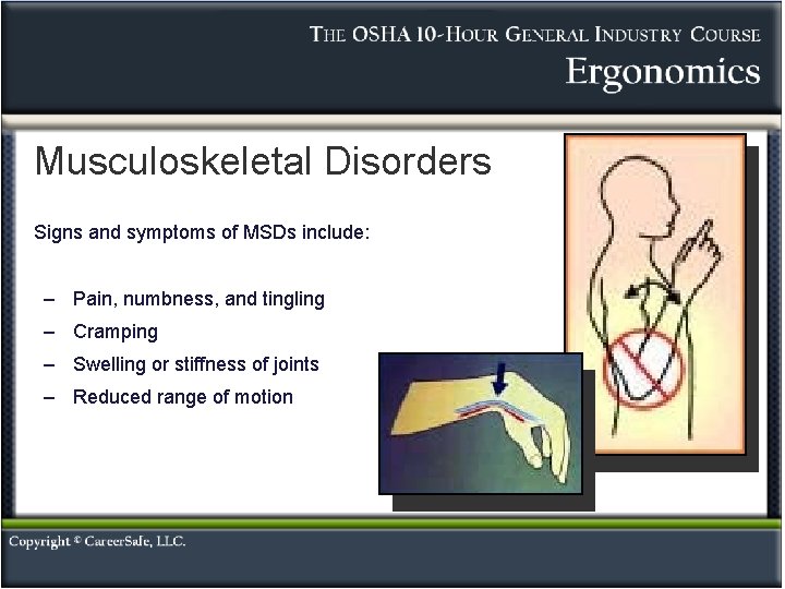 Musculoskeletal Disorders Signs and symptoms of MSDs include: – Pain, numbness, and tingling – Musculoskeletal Disorders Signs and symptoms of MSDs include: – Pain, numbness, and tingling –