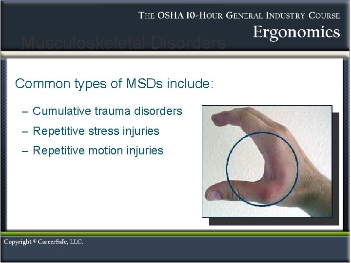 Musculoskeletal Disorders Common types of MSDs include: – Cumulative trauma disorders – Repetitive stress Musculoskeletal Disorders Common types of MSDs include: – Cumulative trauma disorders – Repetitive stress