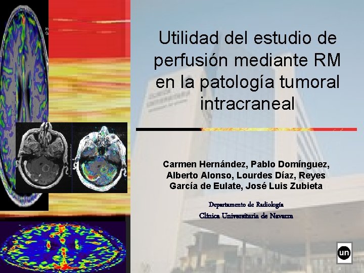 Utilidad del estudio de perfusión mediante RM en la patología tumoral intracraneal Carmen Hernández,