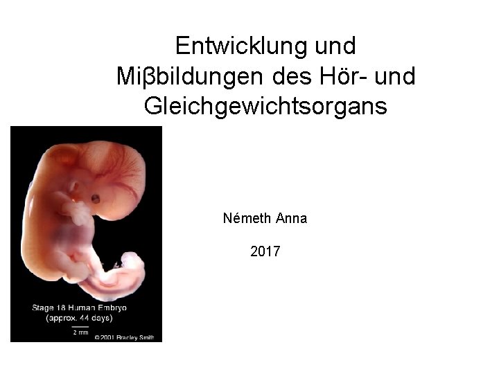 Entwicklung und Miβbildungen des Hör- und Gleichgewichtsorgans Németh Anna 2017 